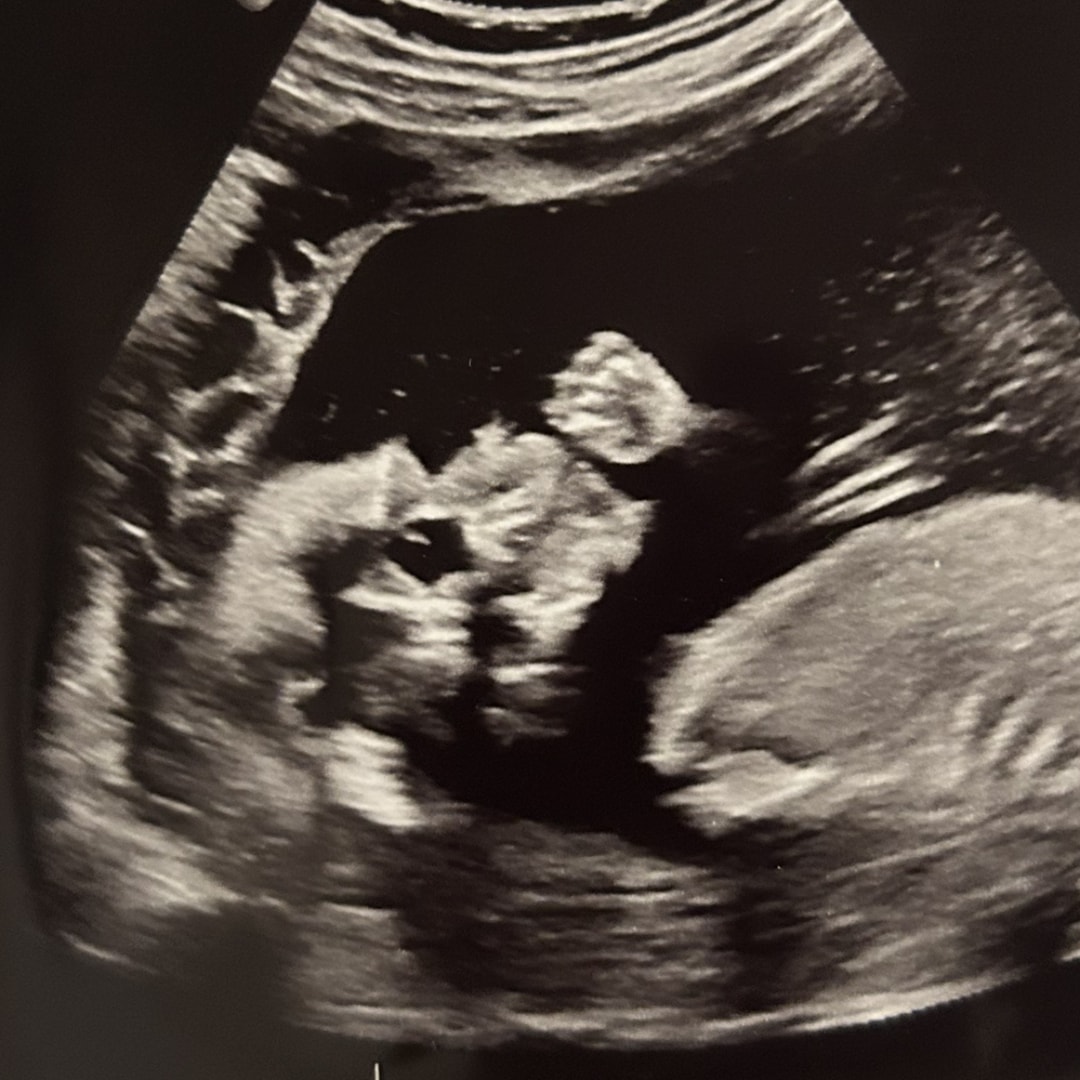 Photo shared by Kait for their Babylist baby registry.
