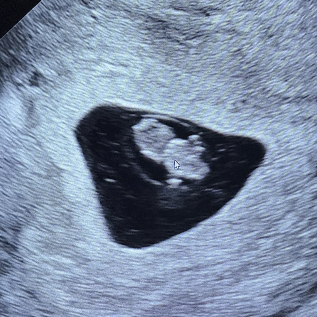 Photo shared by Nicole for their Babylist baby registry.
