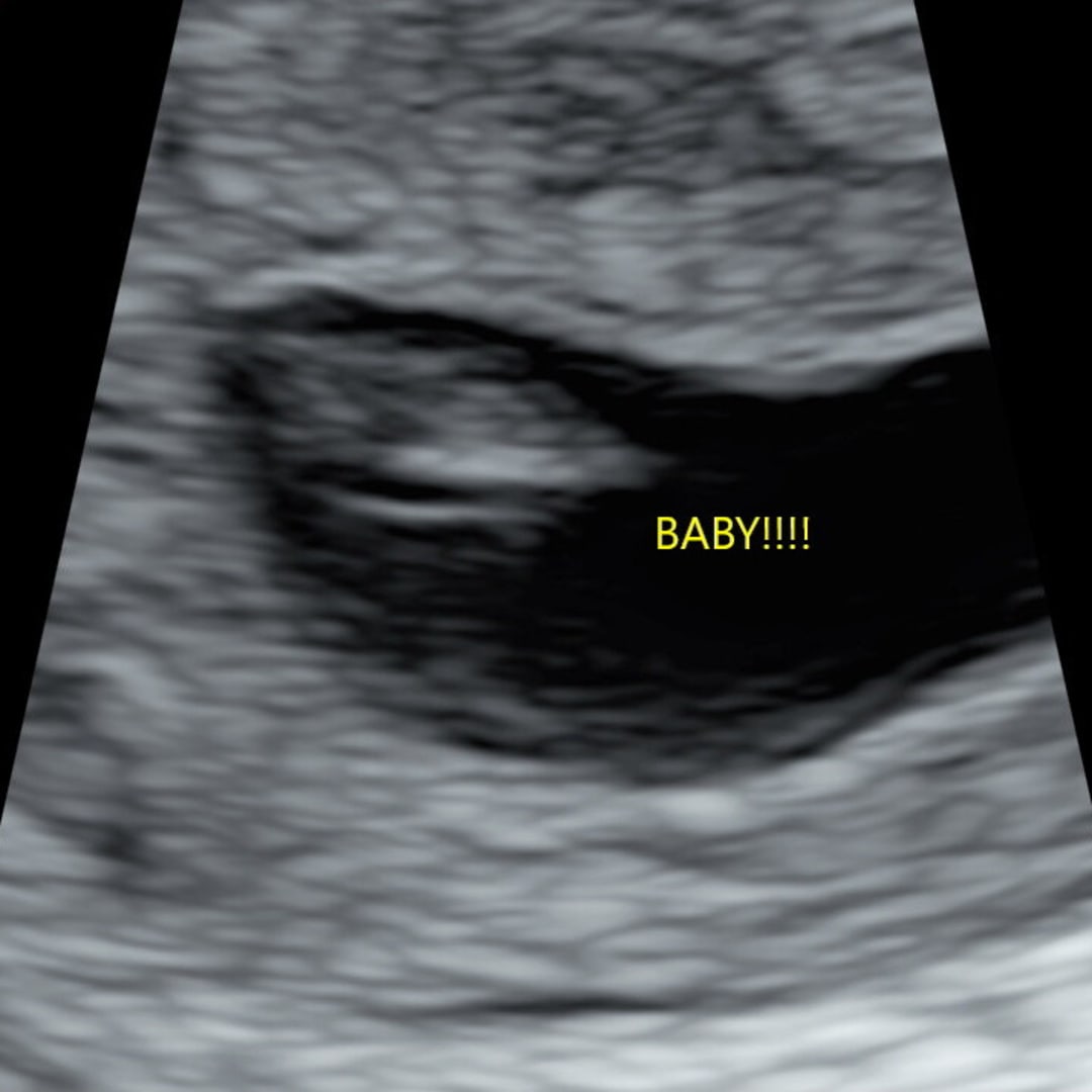 Photo shared by Brianna for their Babylist baby registry.