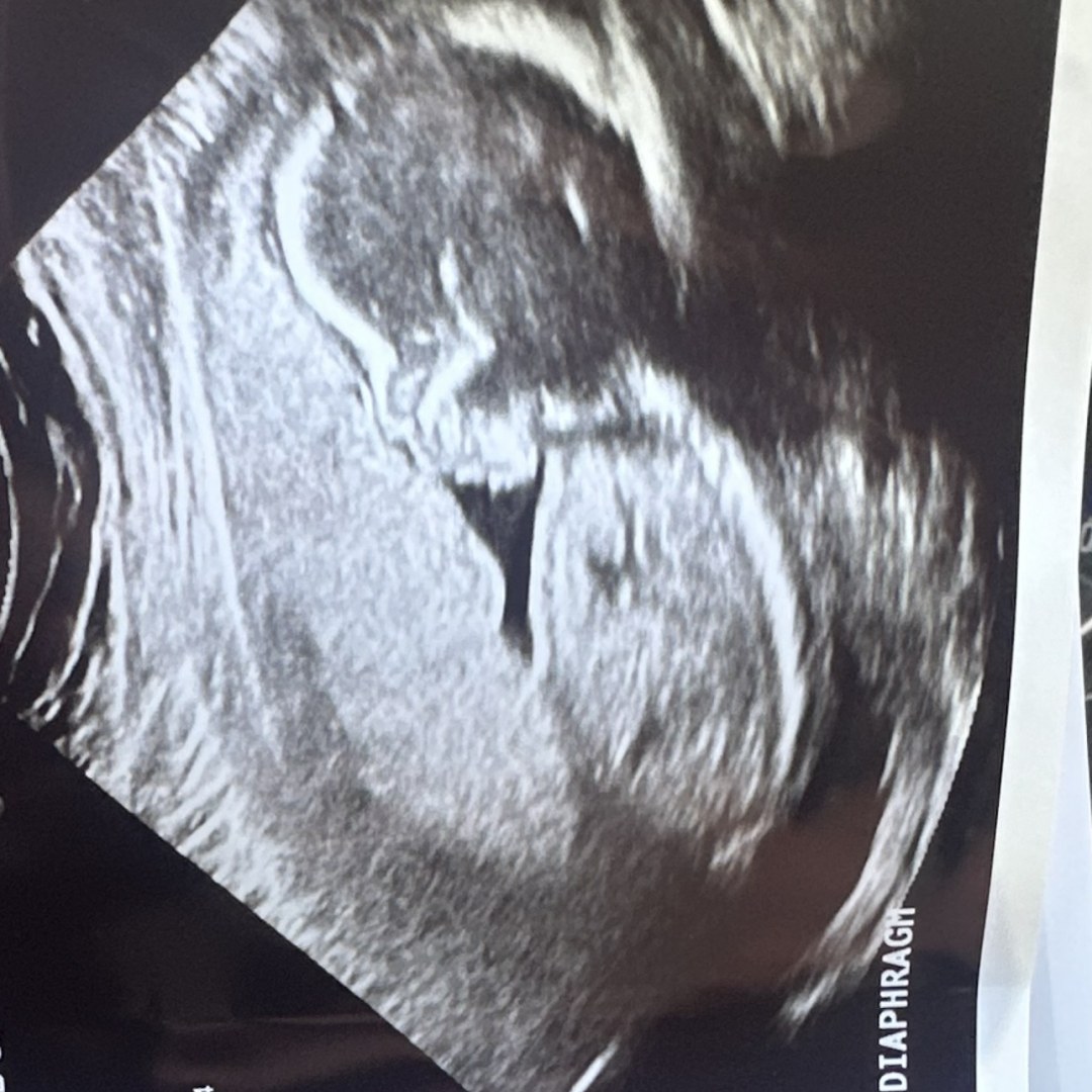 Photo shared by Lindsey for their Babylist baby registry.