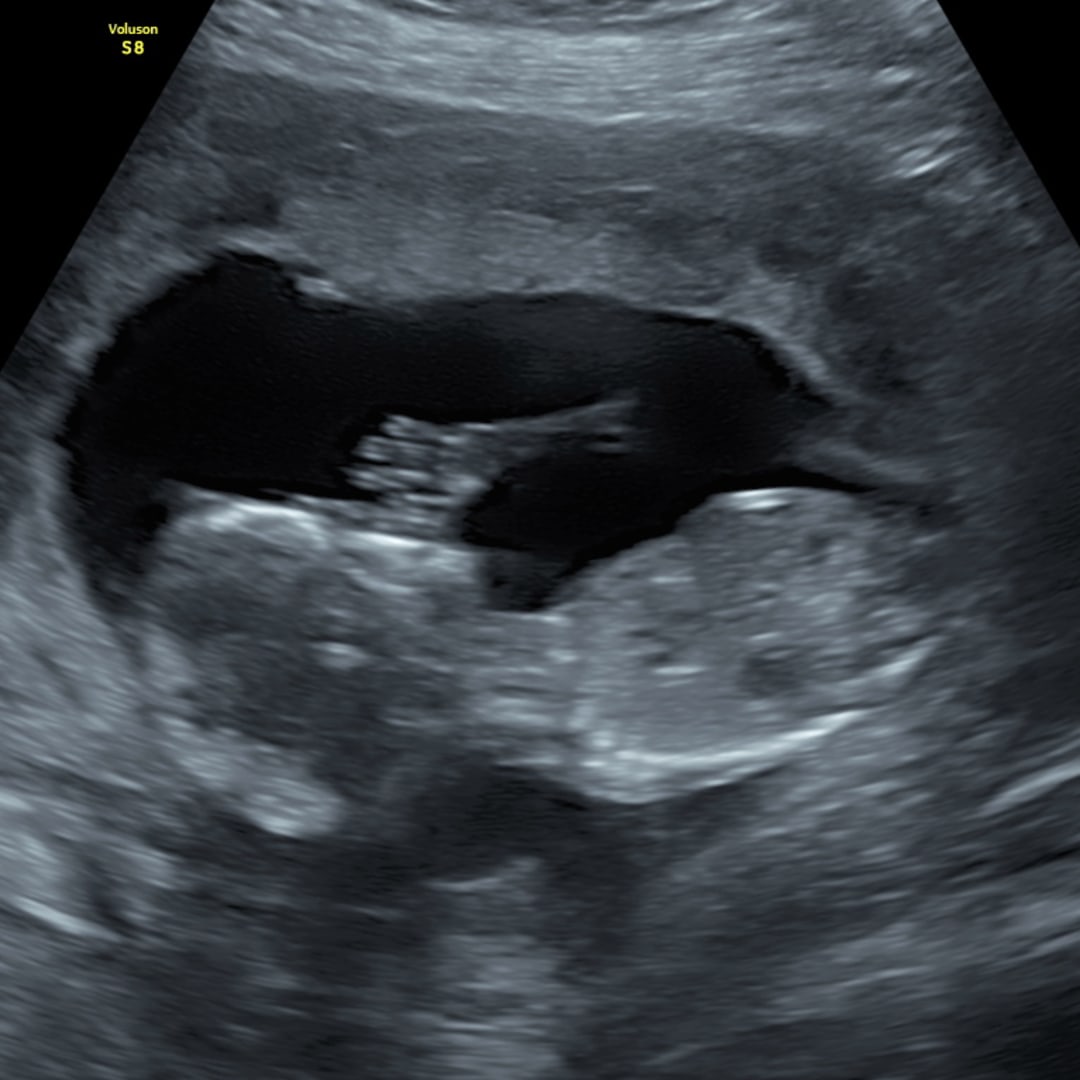 Photo shared by Hannah for their Babylist baby registry.