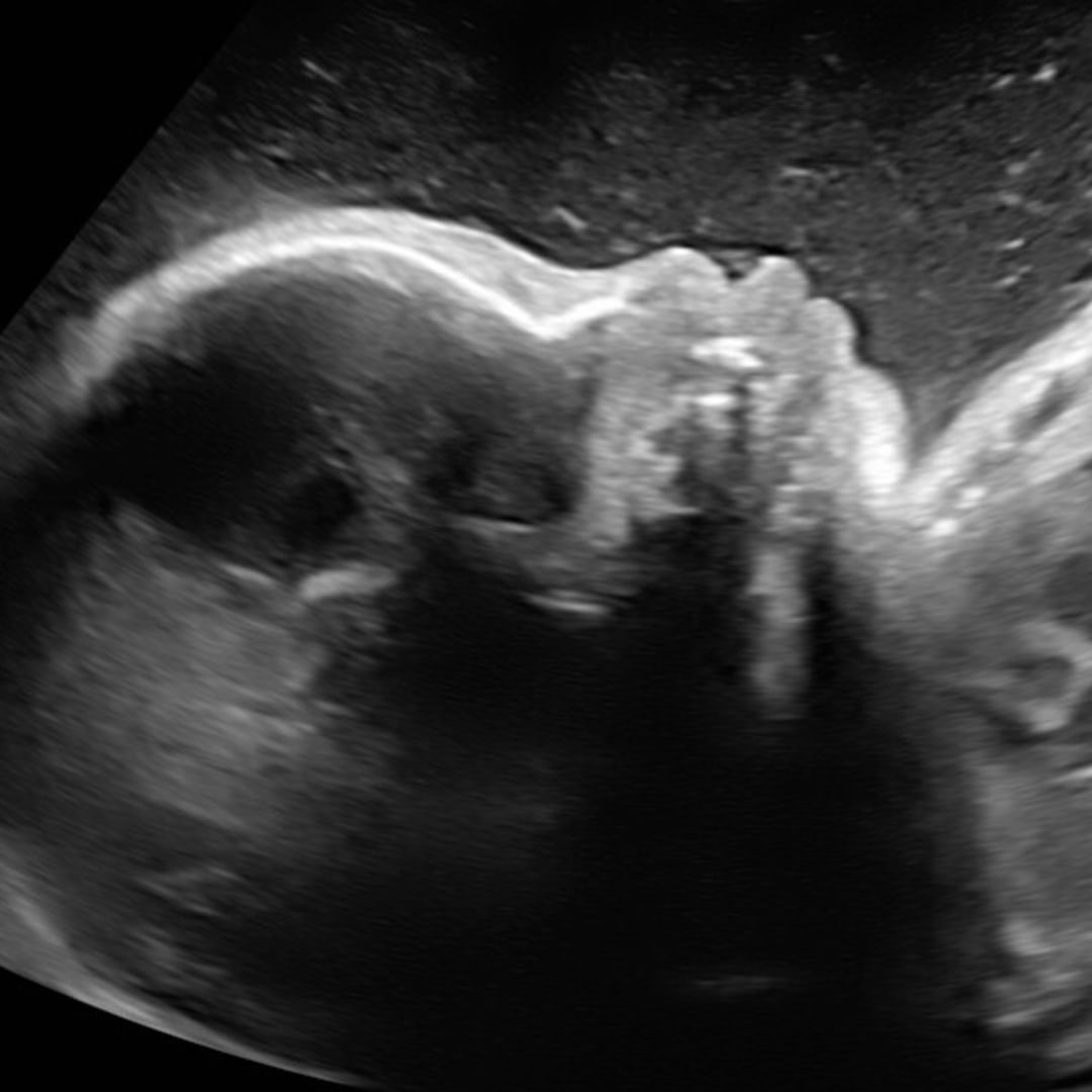 Photo shared by Elise for their Babylist baby registry.