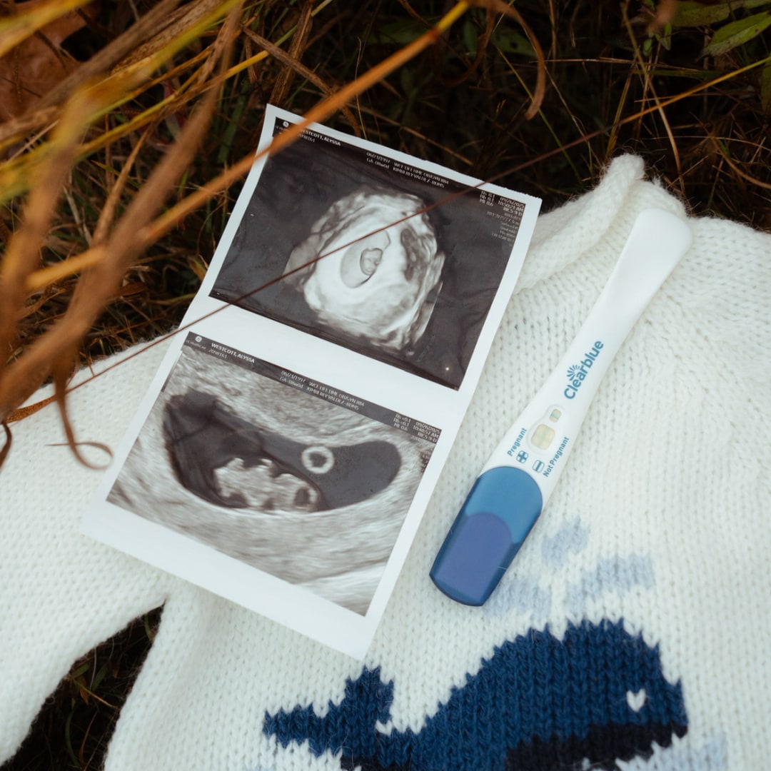 Photo shared by Alyssa for their Babylist baby registry.