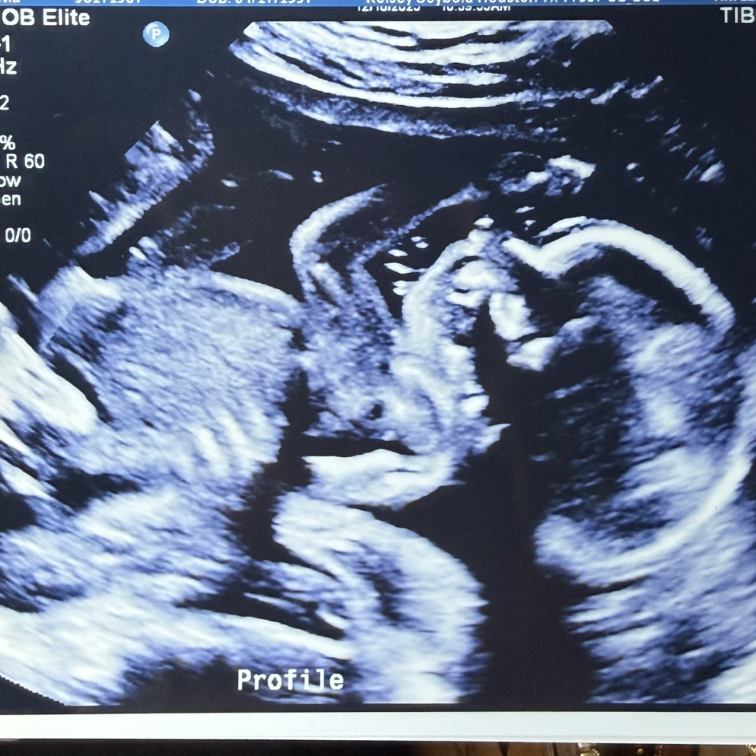 Photo shared by Nia for their Babylist baby registry.