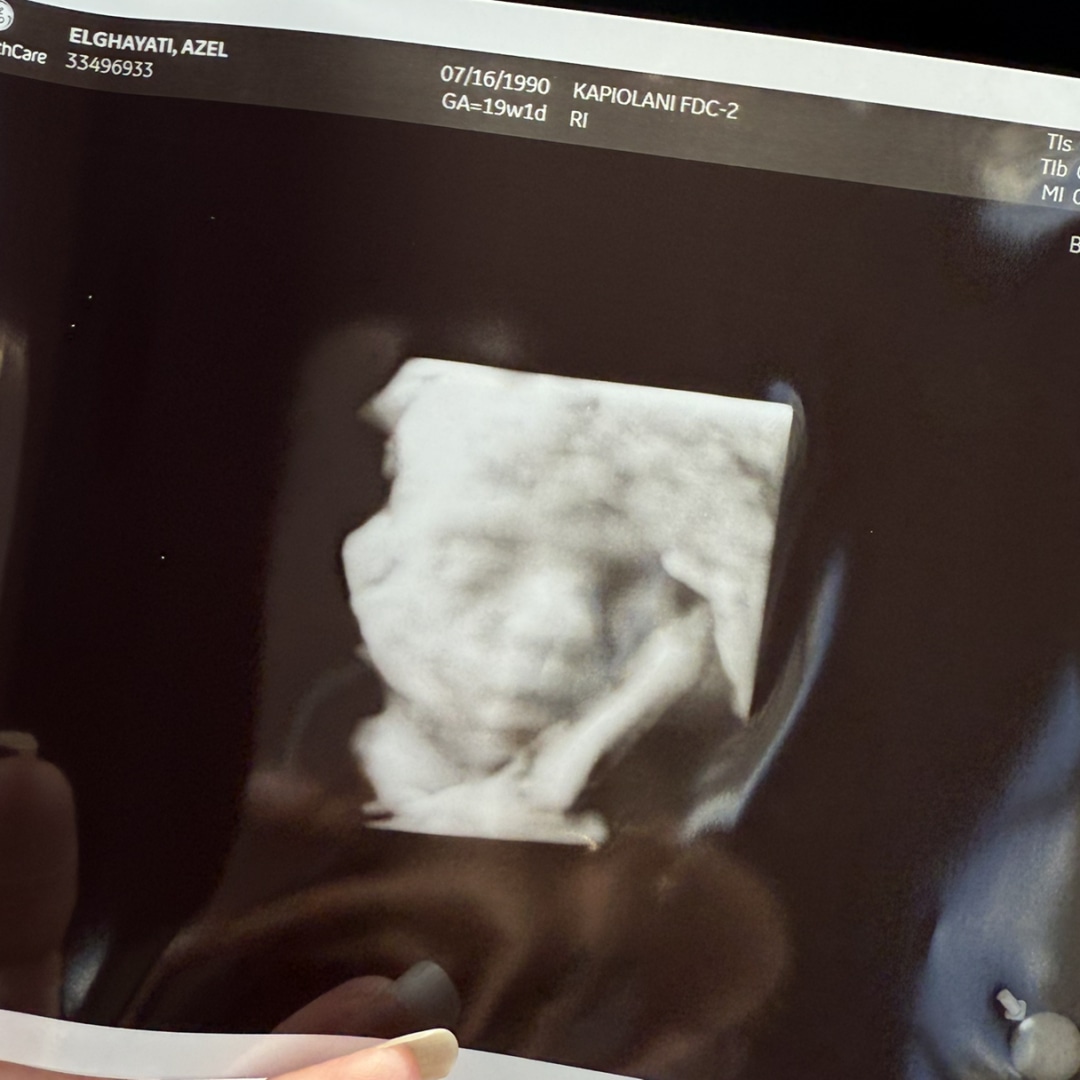 Photo shared by Azel for their Babylist baby registry.