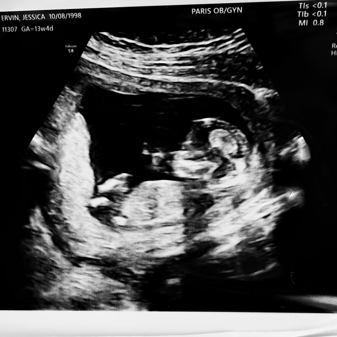 Photo shared by Jessica for their Babylist baby registry.