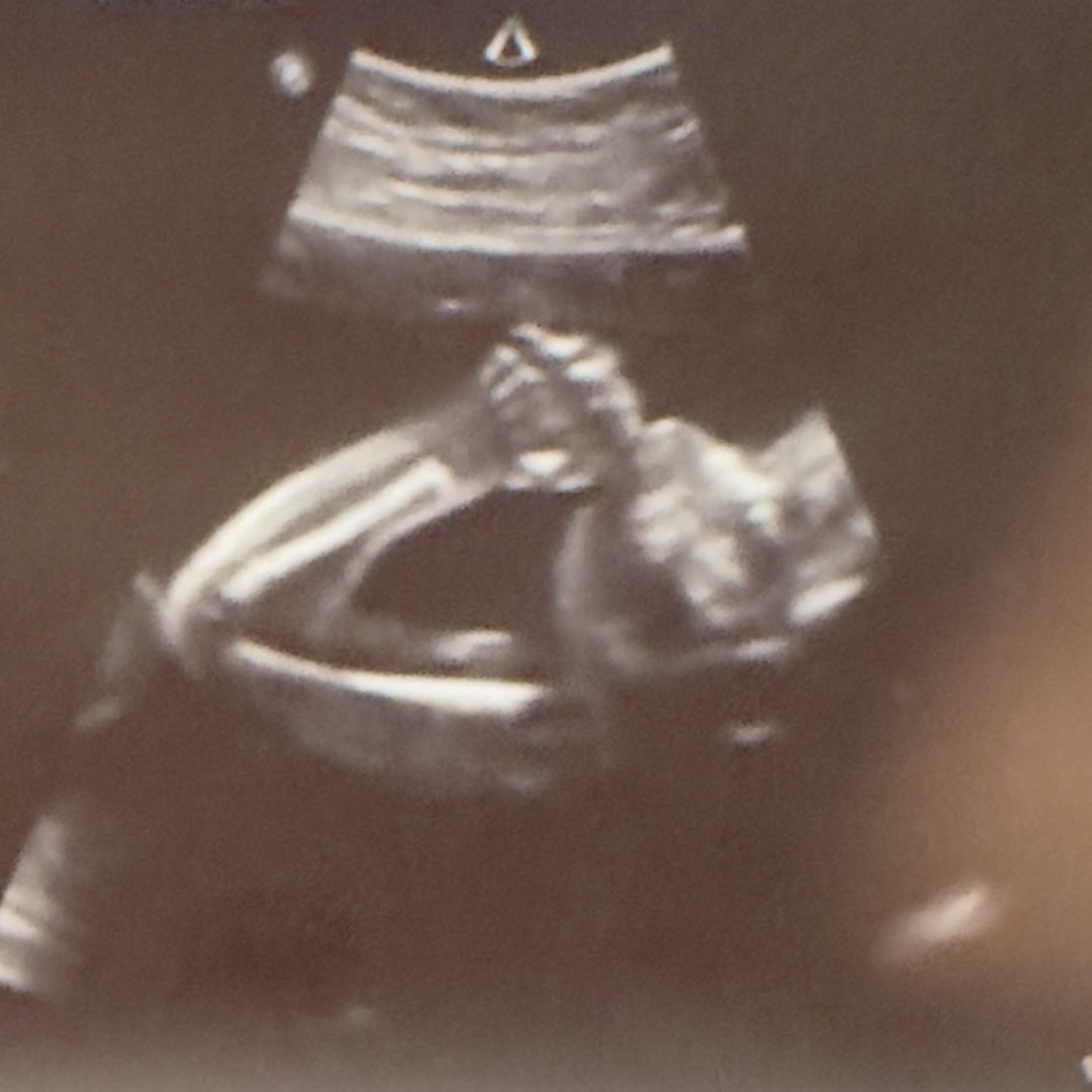 Photo shared by Abigail for their Babylist baby registry.