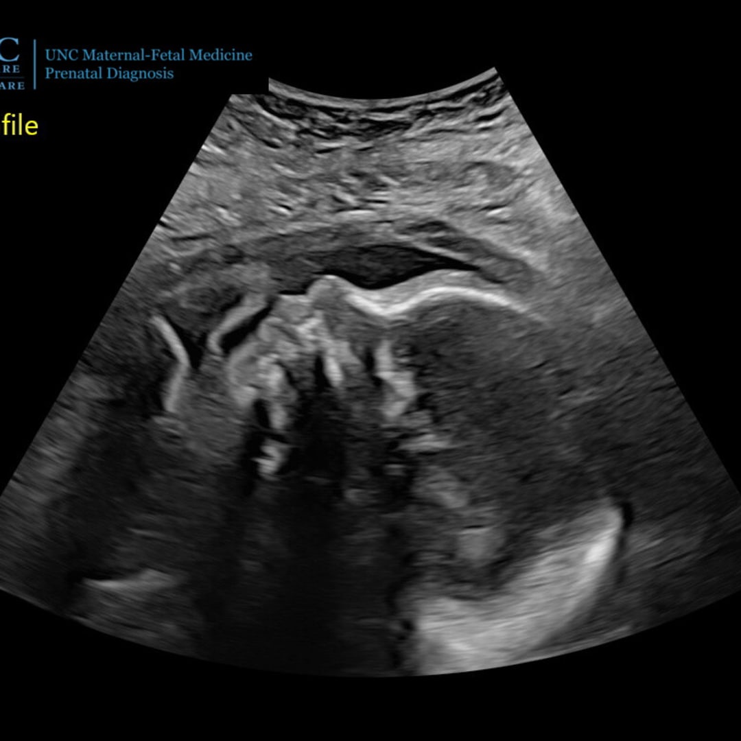 Photo shared by Nikayla for their Babylist baby registry.