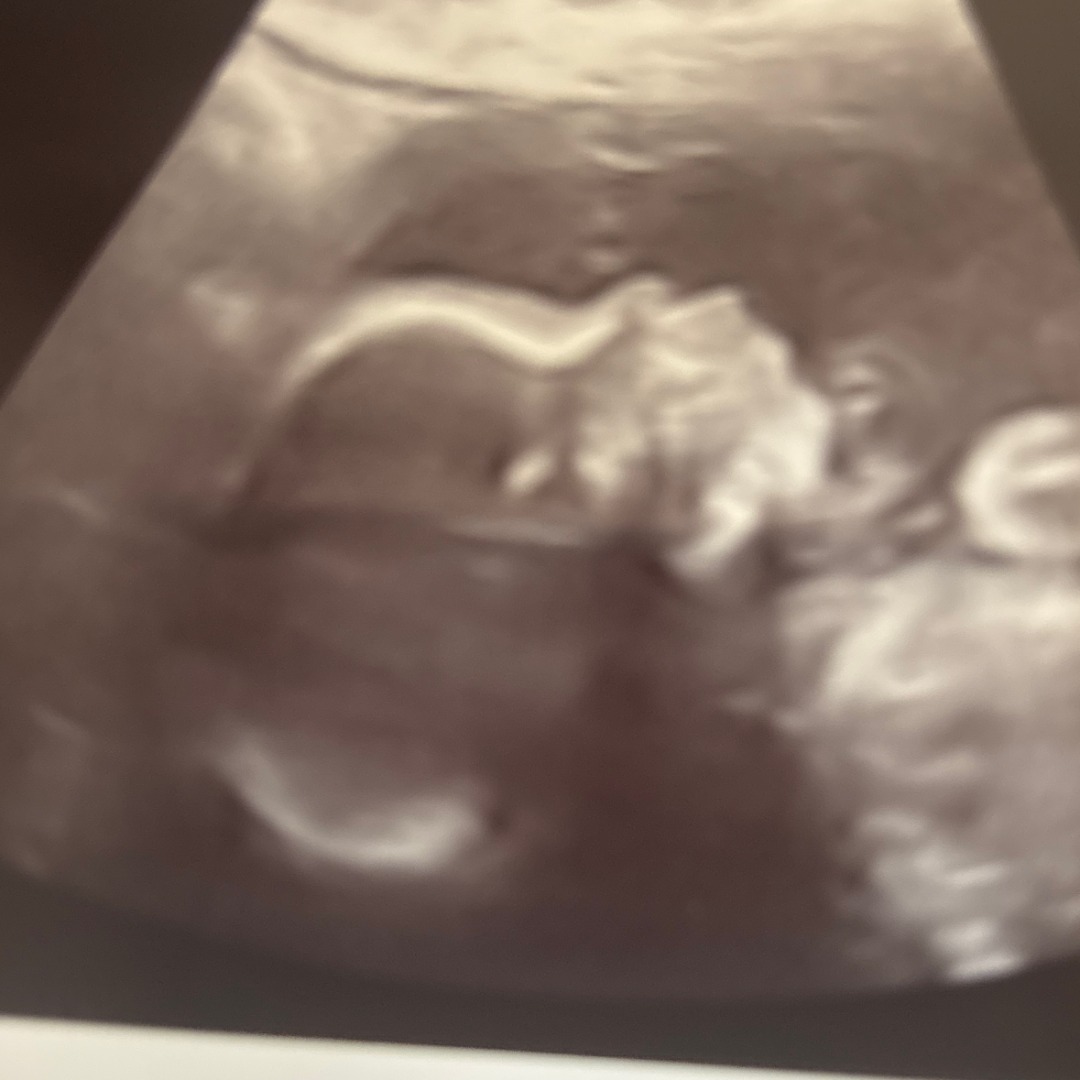 Photo shared by Isabella for their Babylist baby registry.