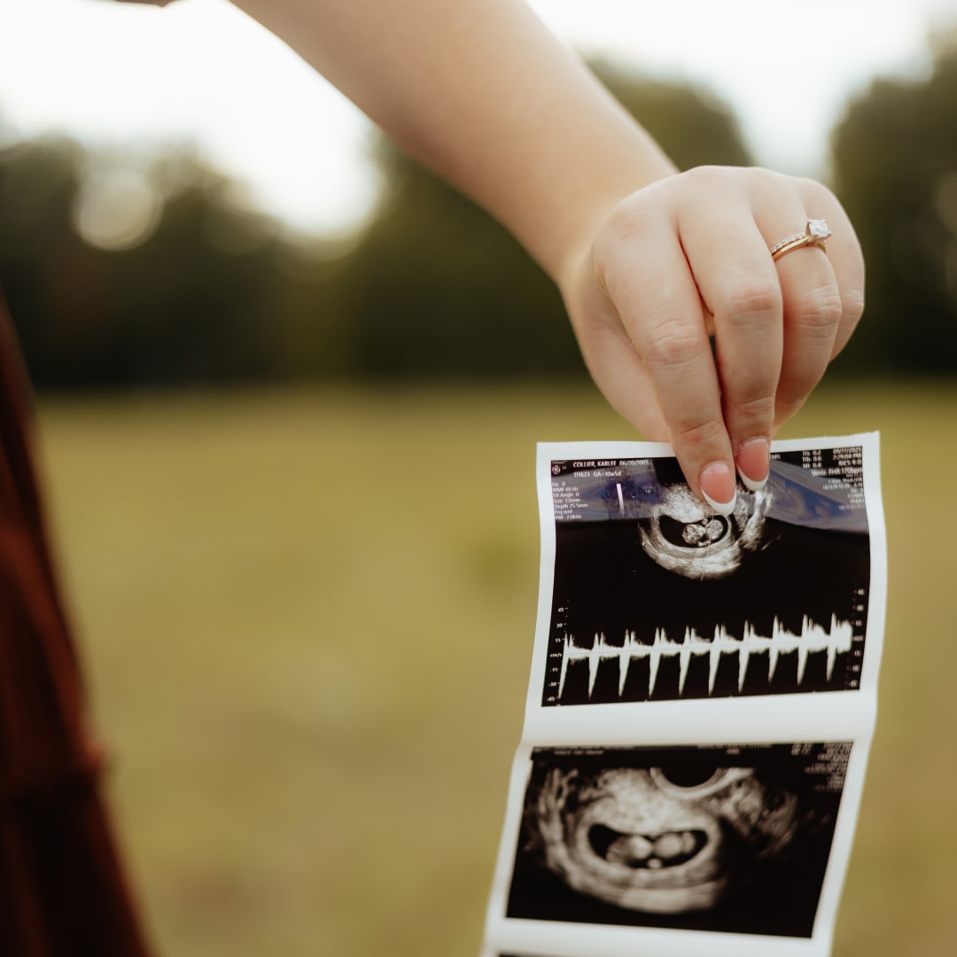 Photo shared by Karlee for their Babylist baby registry.