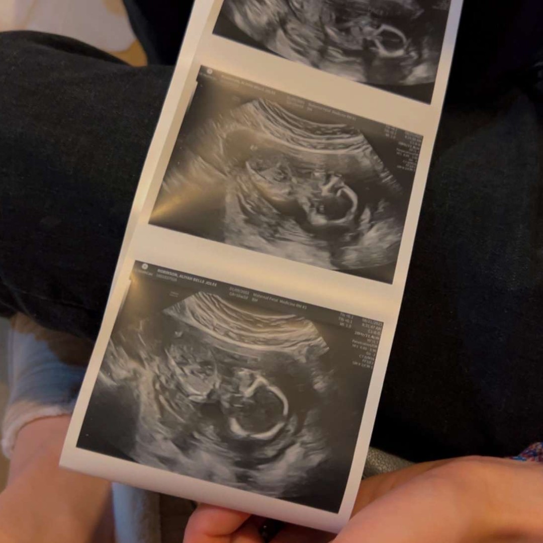 Photo shared by Aliyah for their Babylist baby registry.