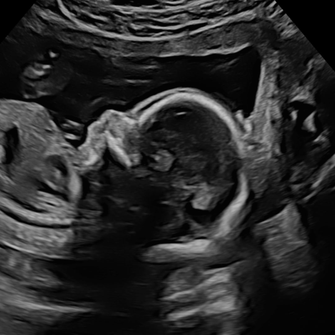 Photo shared by Emma for their Babylist baby registry.