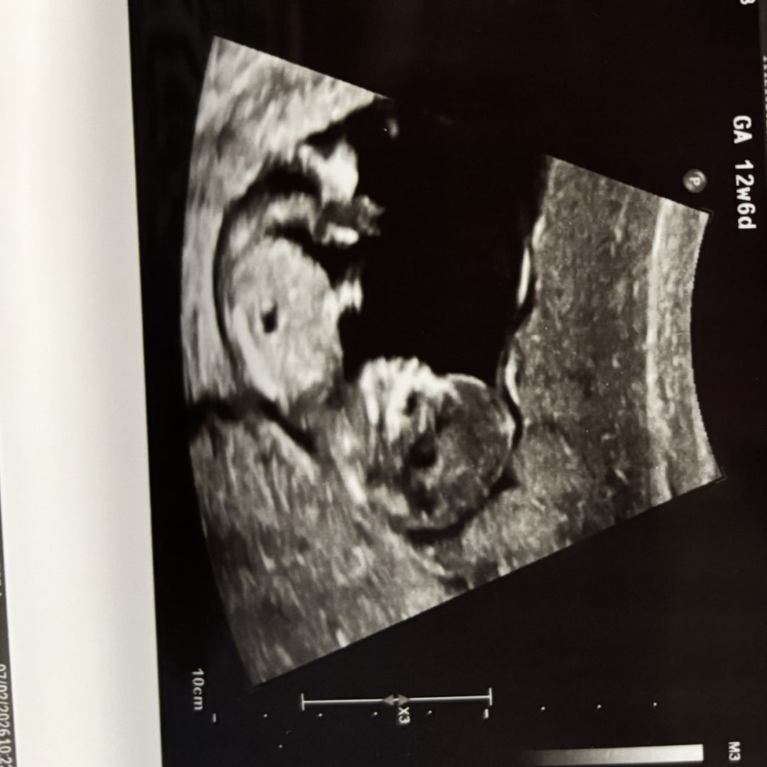 Photo shared by Justus for their Babylist baby registry.