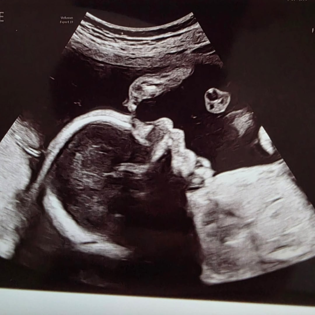 Photo shared by Ann for their Babylist baby registry.