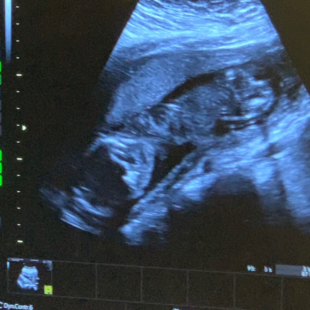 Photo shared by Kyah for their Babylist baby registry.
