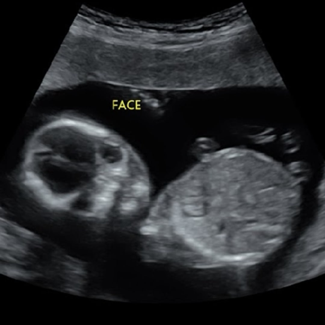 Photo shared by Angelica for their Babylist baby registry.