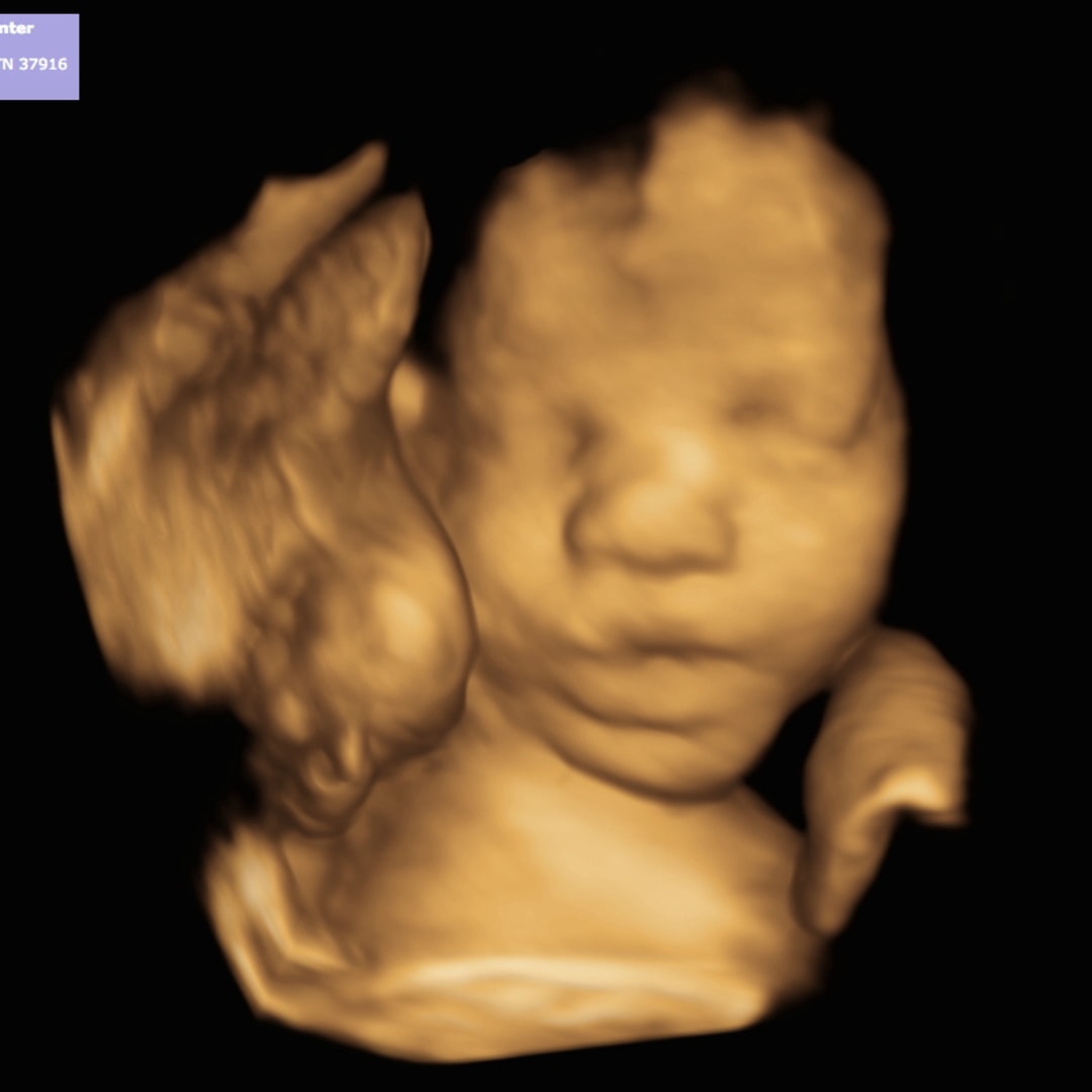 Photo shared by Felicity for their Babylist baby registry.