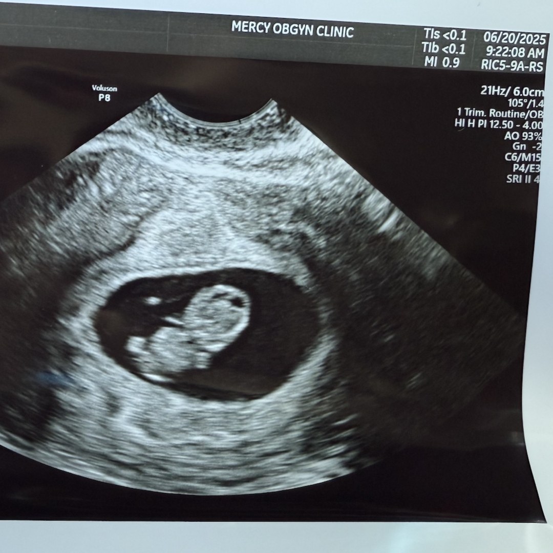 Photo shared by Ally for their Babylist baby registry.