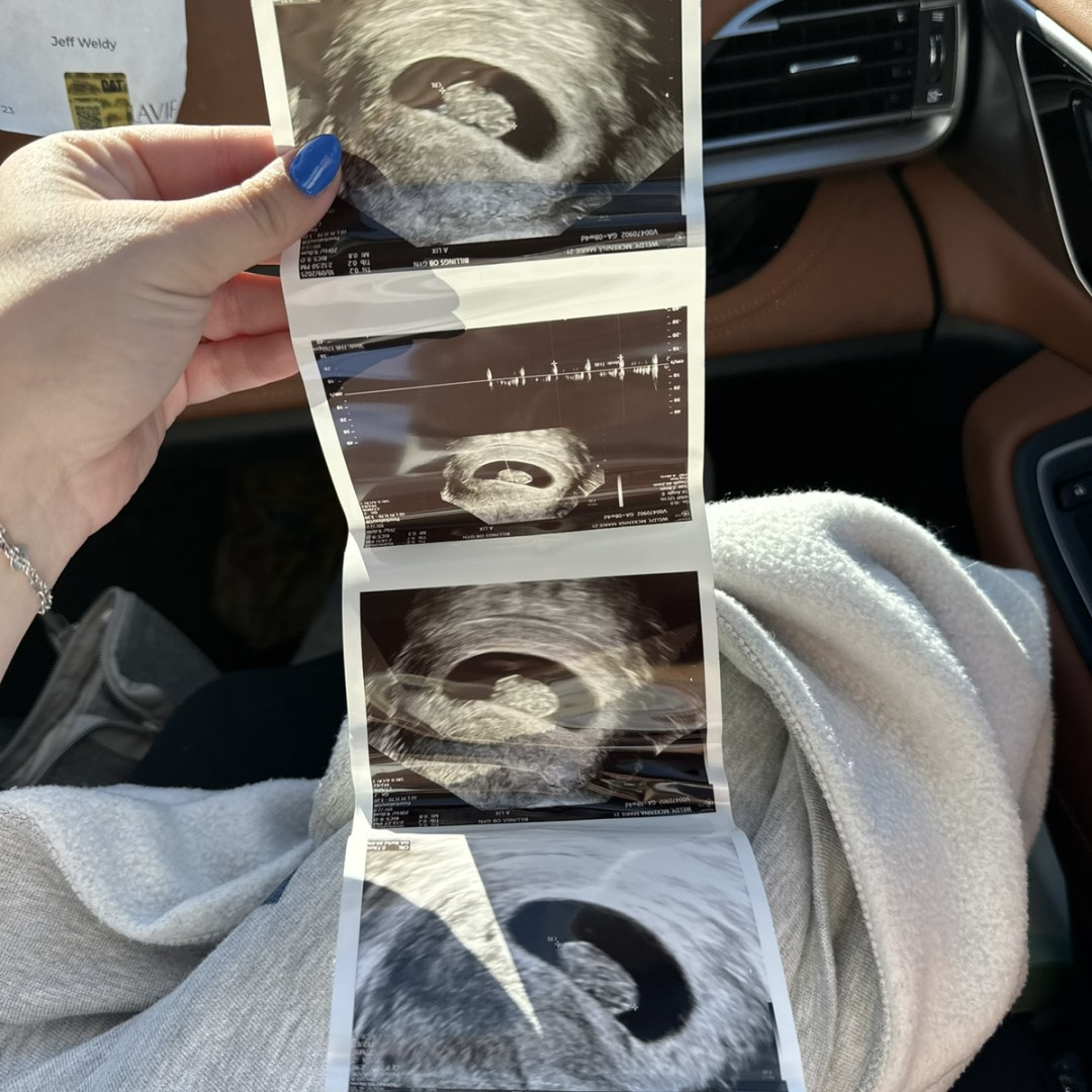 Photo shared by McKenna for their Babylist baby registry.