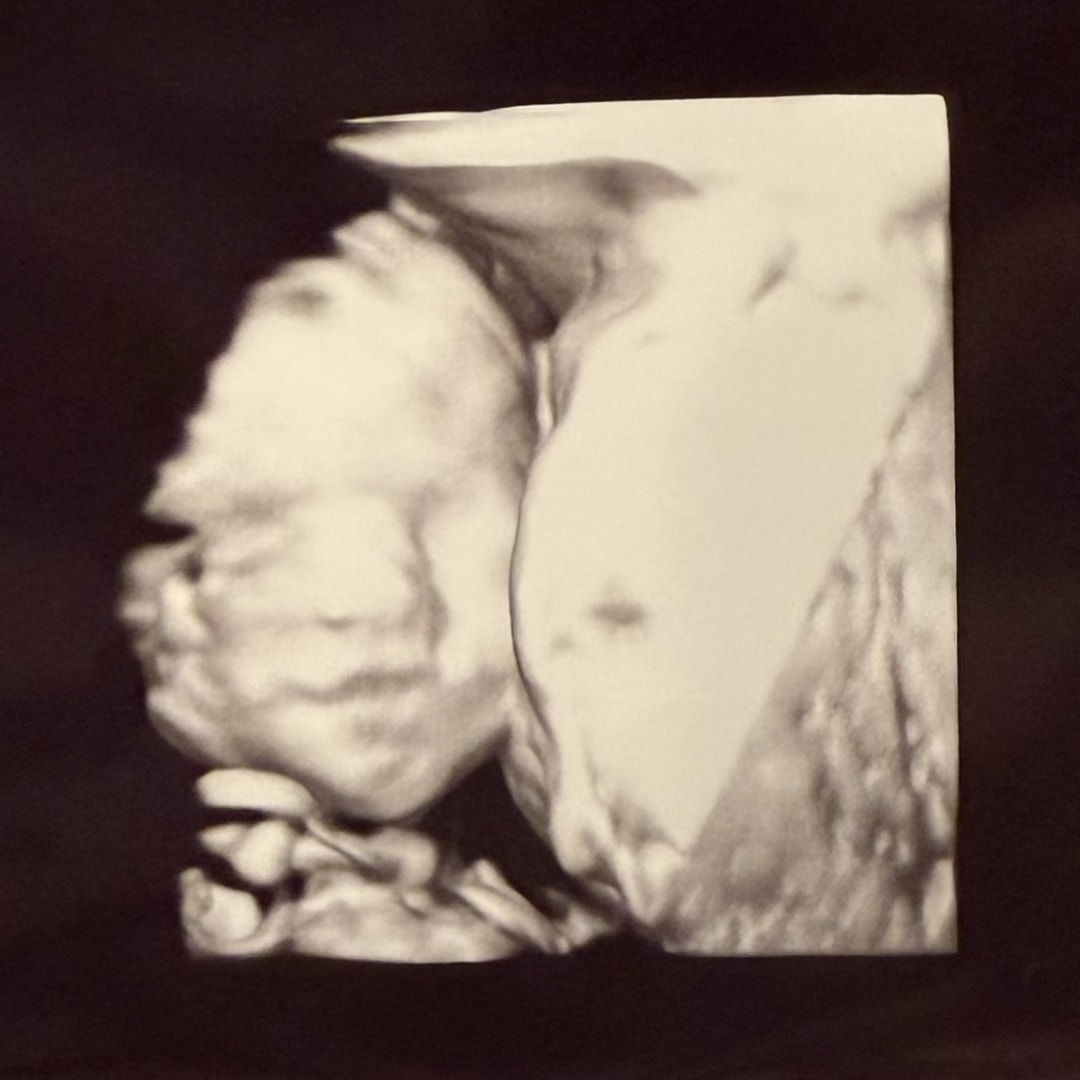 Photo shared by Abby for their Babylist baby registry.