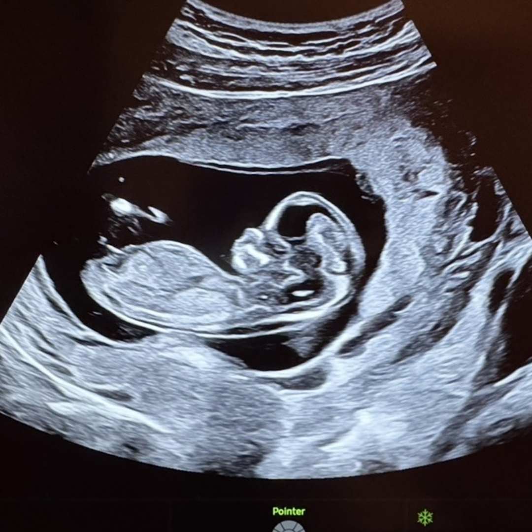 Photo shared by Connie for their Babylist baby registry.