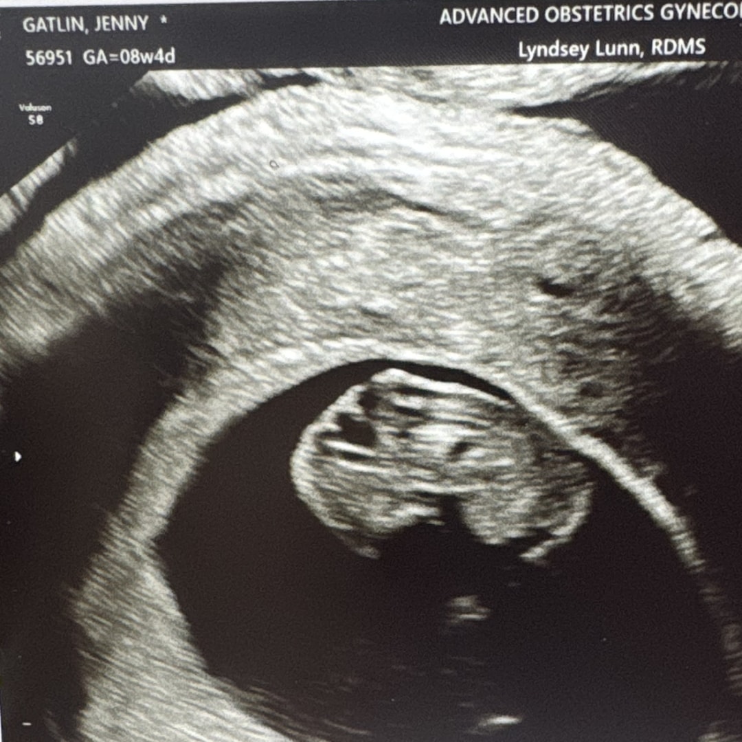 Photo shared by Jenny for their Babylist baby registry.