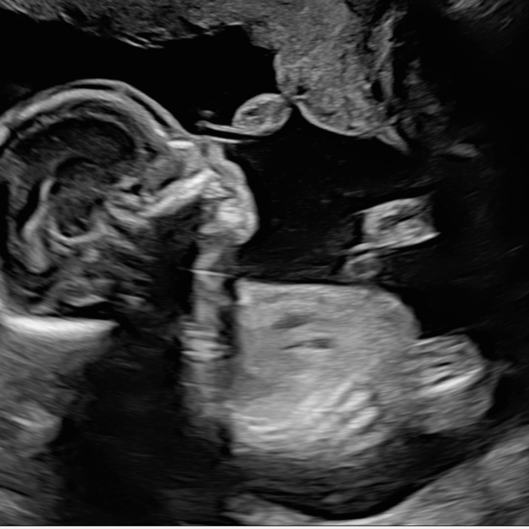 Photo shared by Lydia for their Babylist baby registry.