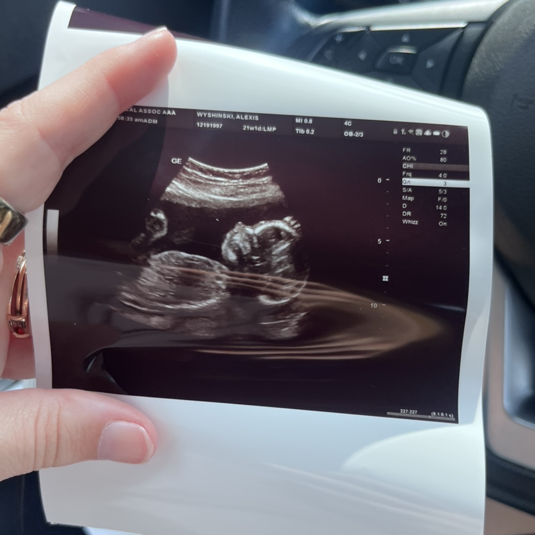 Photo shared by Lexie for their Babylist baby registry.