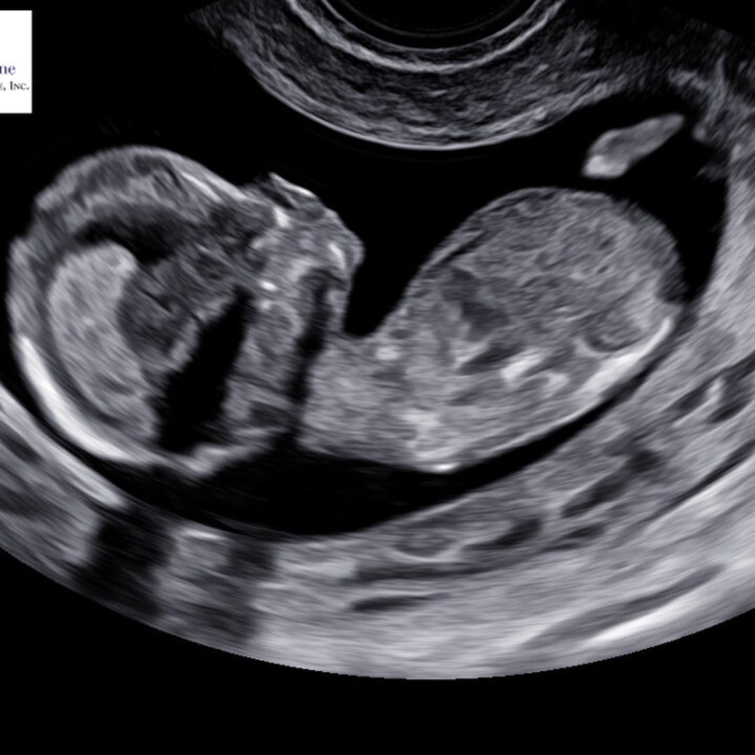 Photo shared by Allyson for their Babylist baby registry.