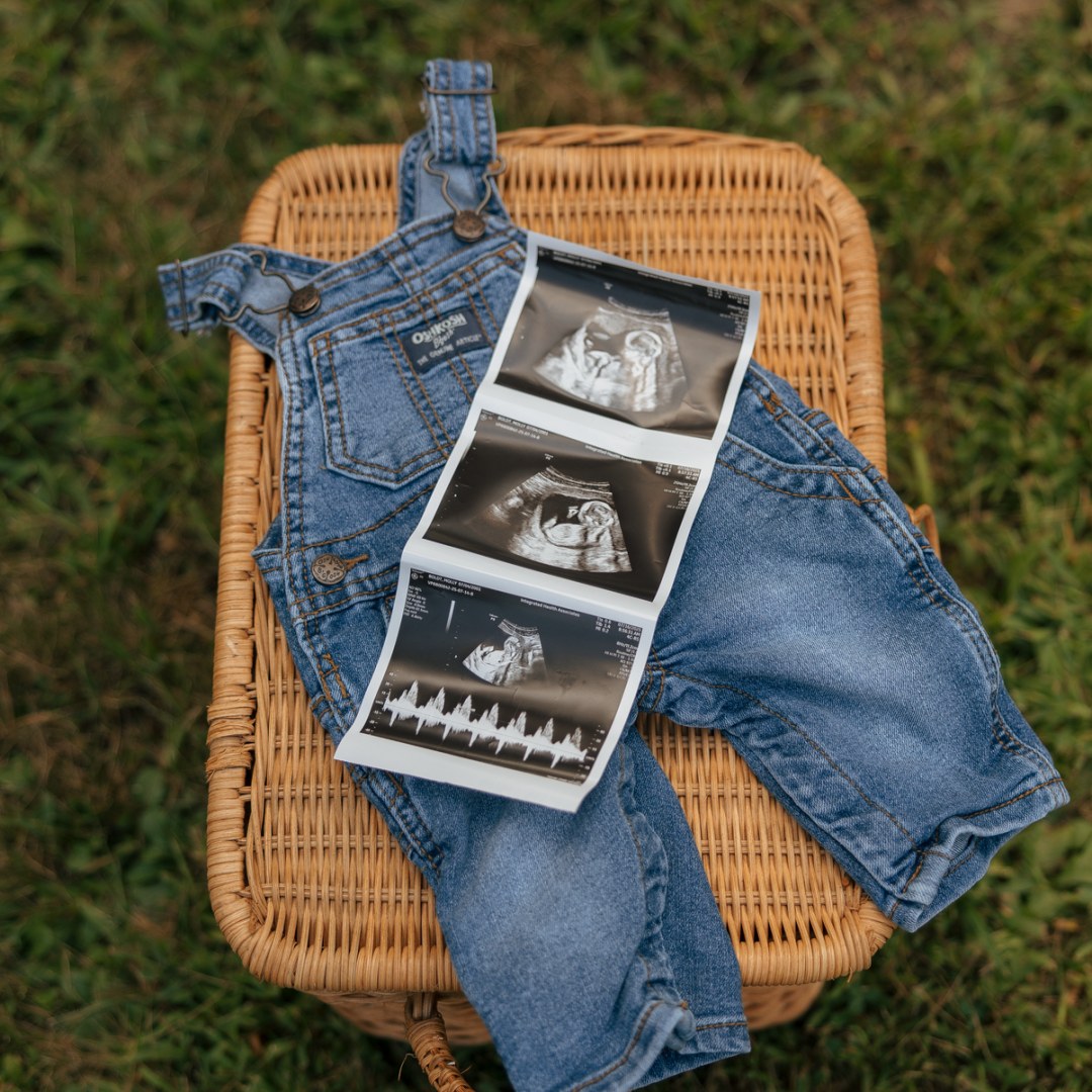 Photo shared by Molly for their Babylist baby registry.