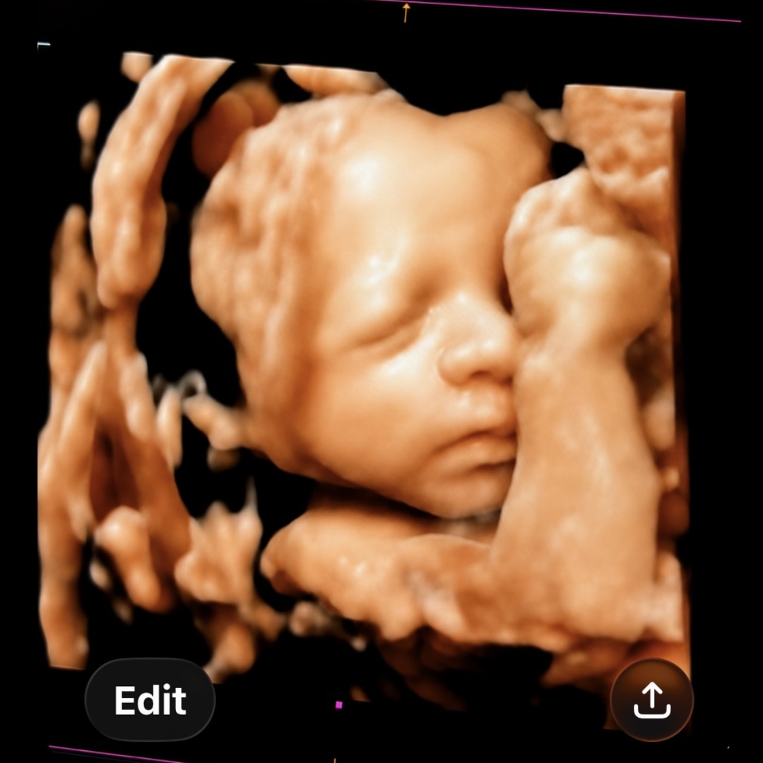 Photo shared by Caitlin for their Babylist baby registry.