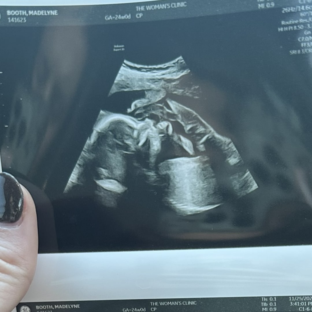 Photo shared by Madelyne for their Babylist baby registry.