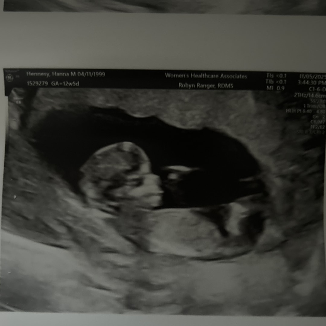 Photo shared by Hanna for their Babylist baby registry.