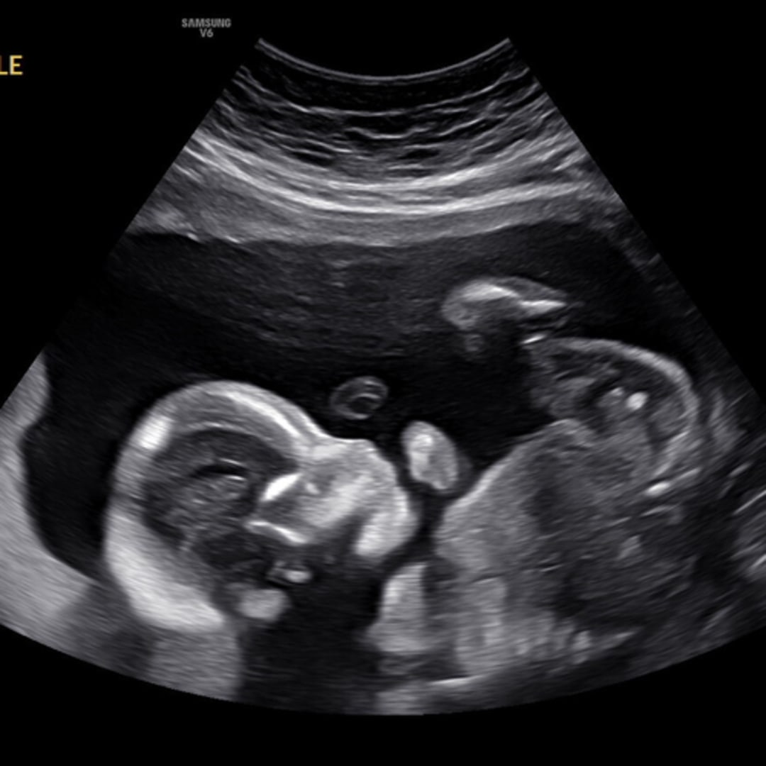 Photo shared by Becca (Rebecca) for their Babylist baby registry.
