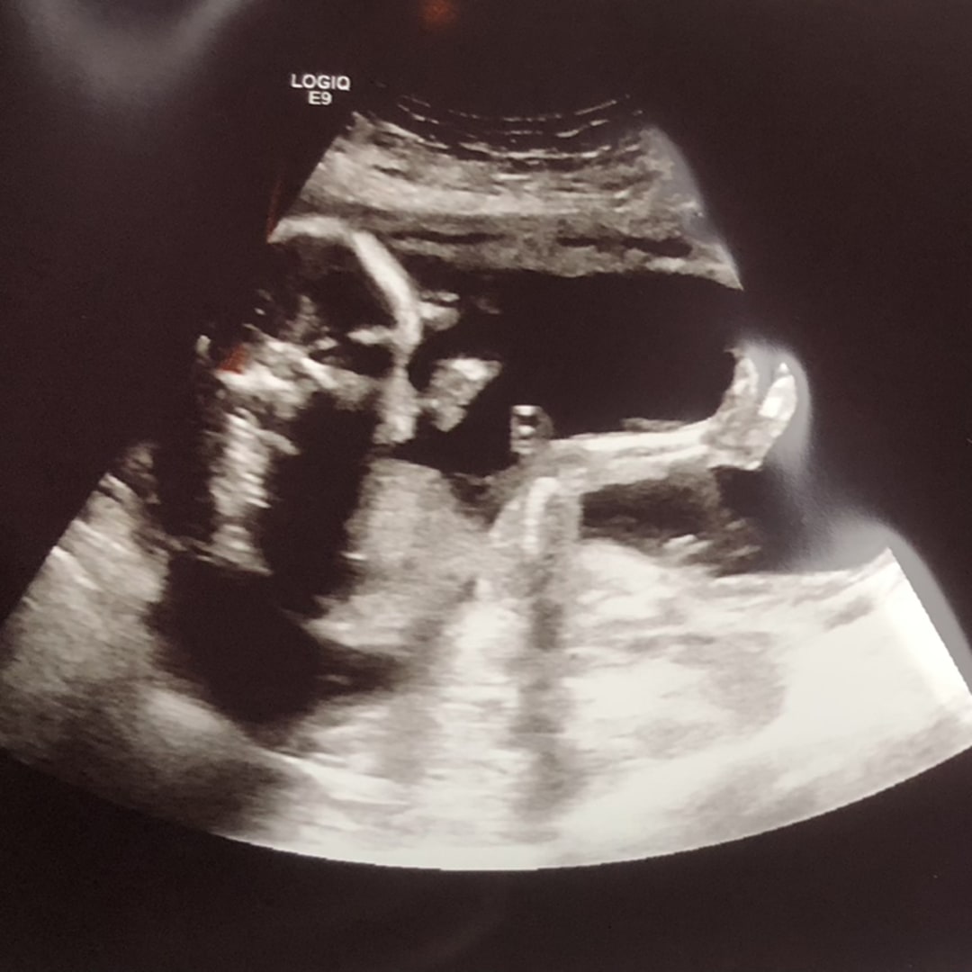 Photo shared by Bryanna for their Babylist baby registry.