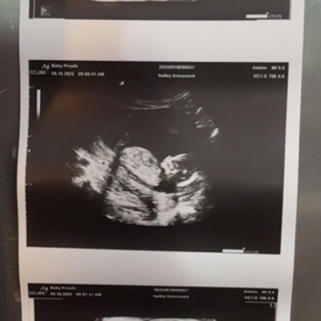 Photo shared by Hailey for their Babylist baby registry.