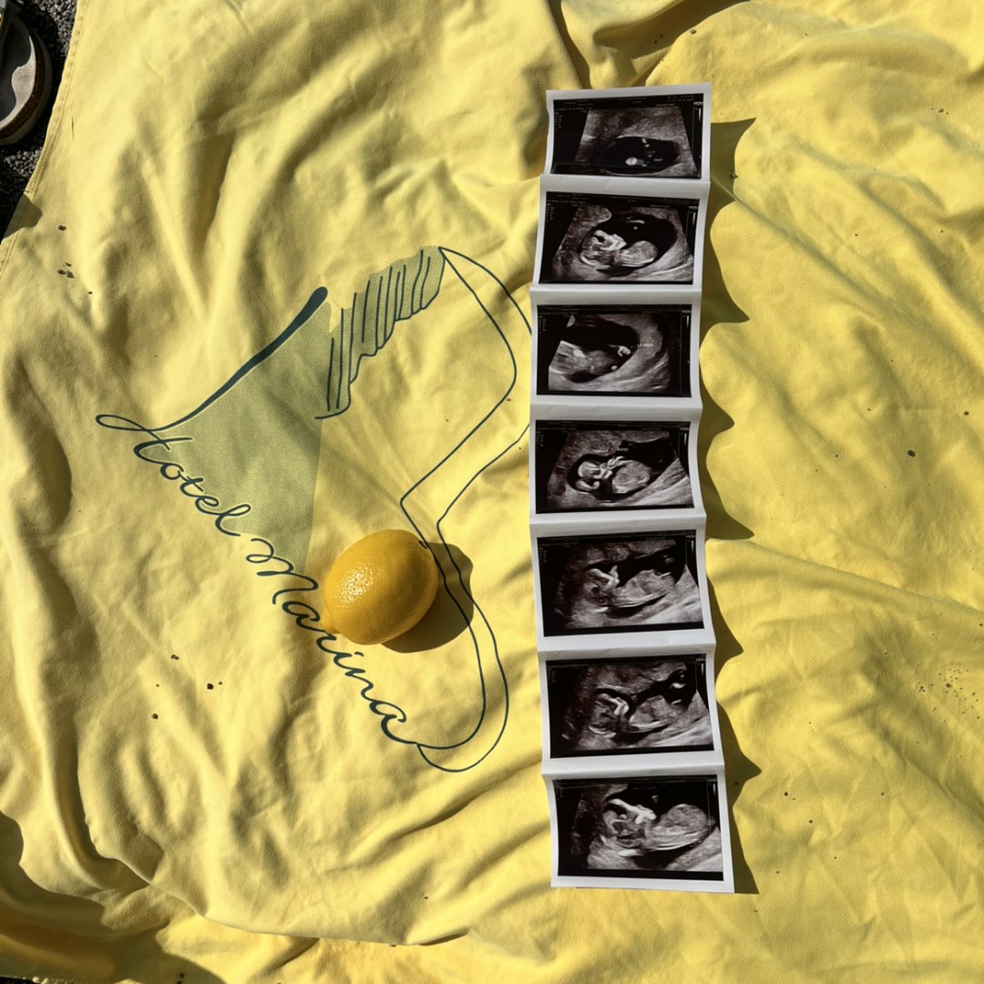 Photo shared by Connie for their Babylist baby registry.