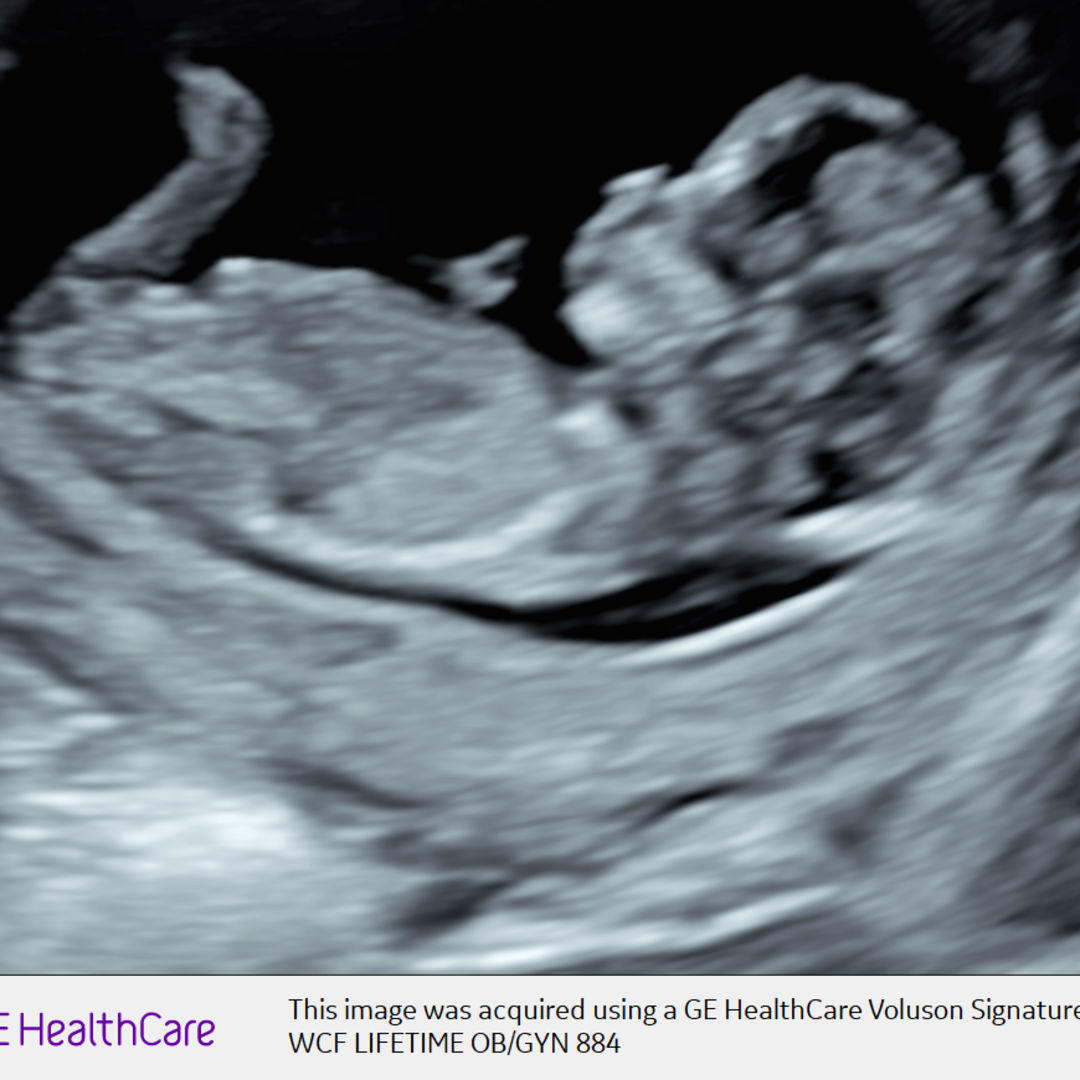 Photo shared by LeeAnn for their Babylist baby registry.