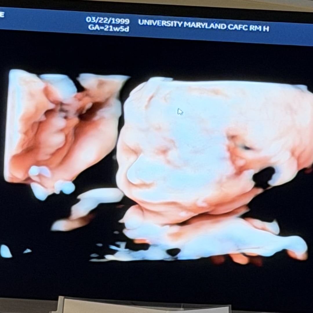 Photo shared by Michelle & Alek for their Babylist baby registry.