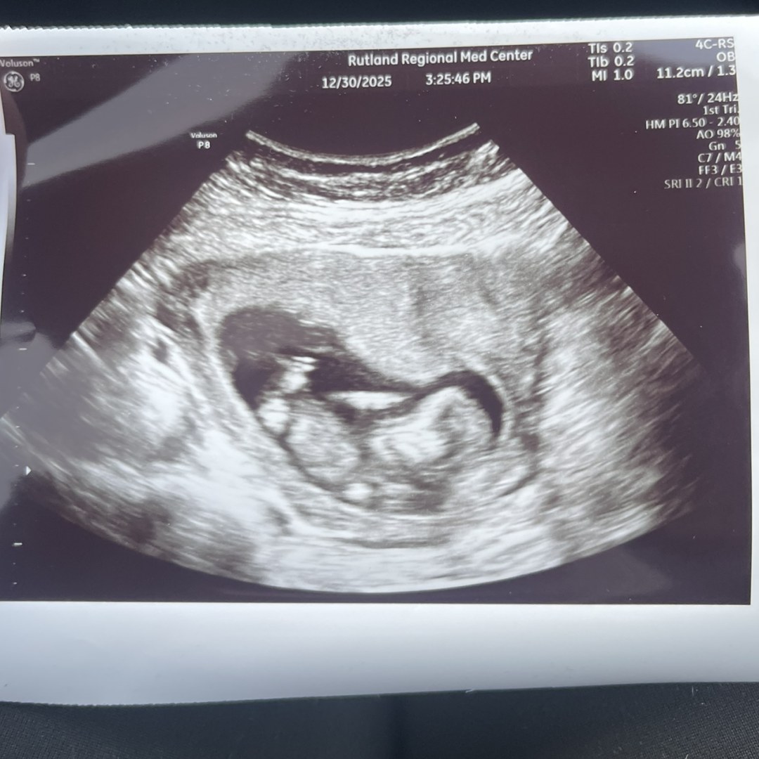 Photo shared by Alyssa for their Babylist baby registry.