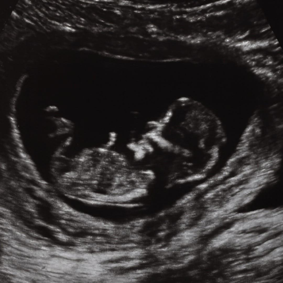 Photo shared by Ashley for their Babylist baby registry.