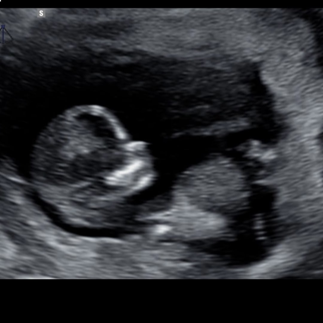 Photo shared by Morgan for their Babylist baby registry.