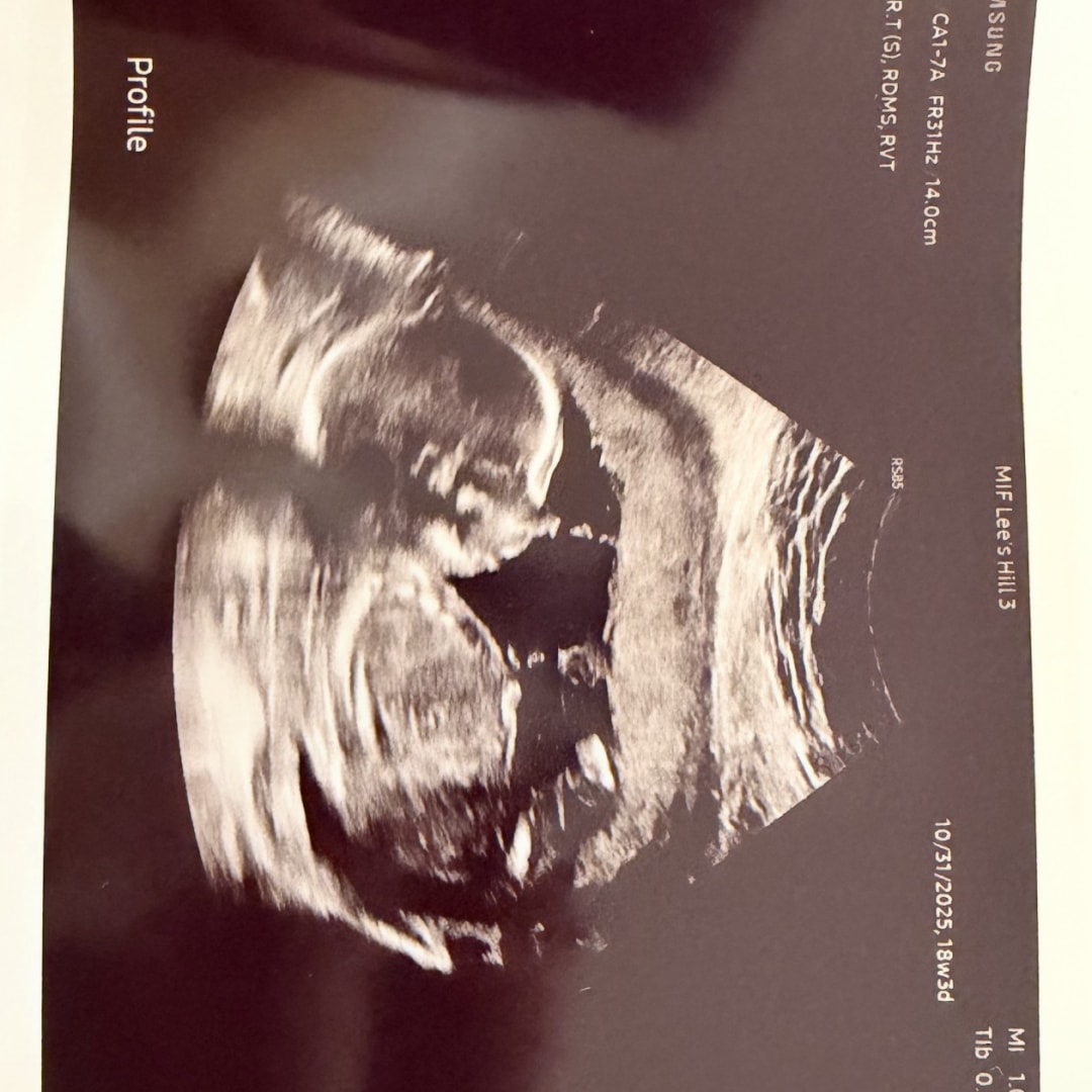 Photo shared by Paige for their Babylist baby registry.
