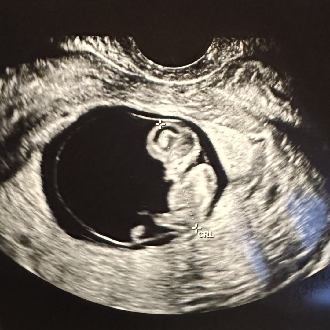 Photo shared by Katherine for their Babylist baby registry.