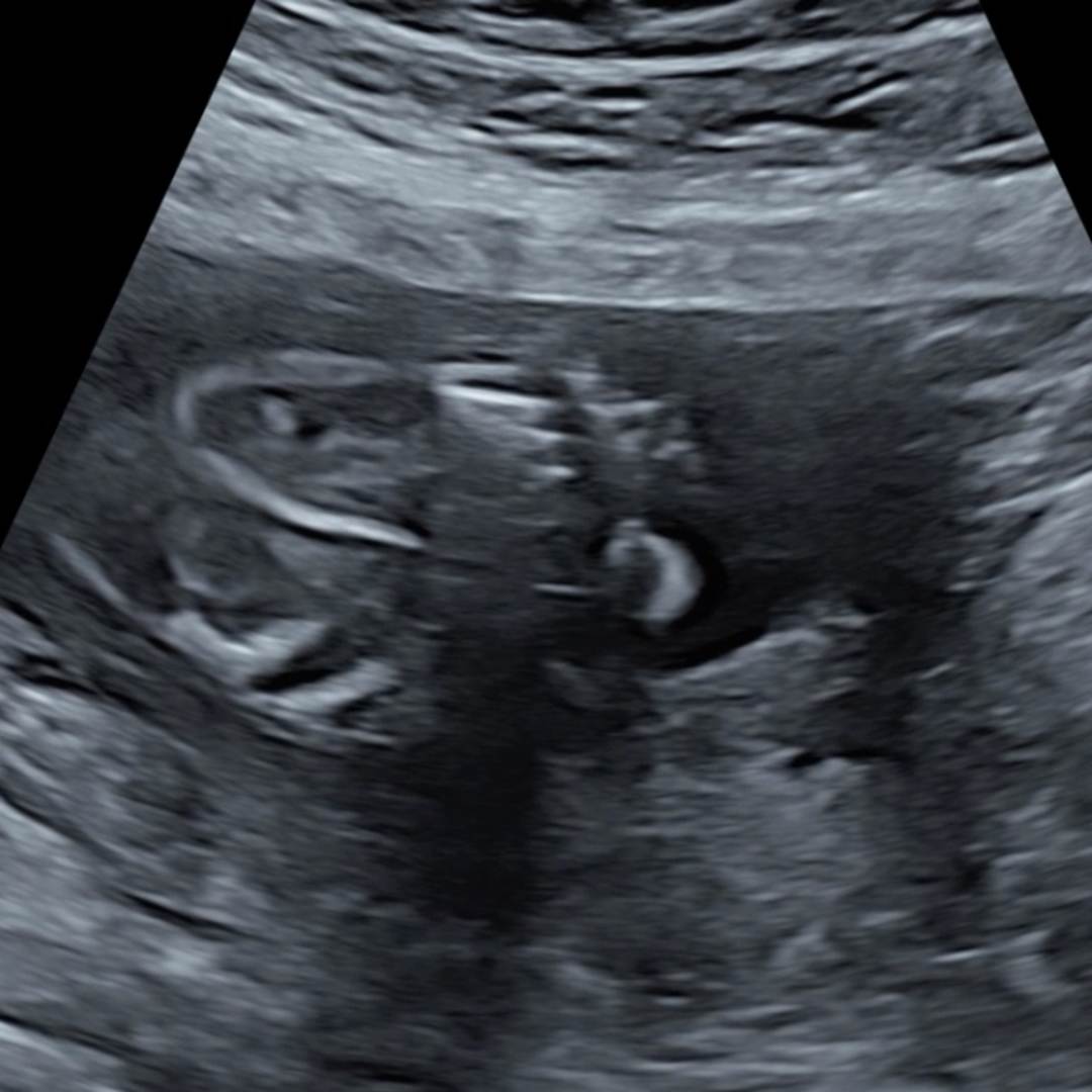 Photo shared by Reyna for their Babylist baby registry.