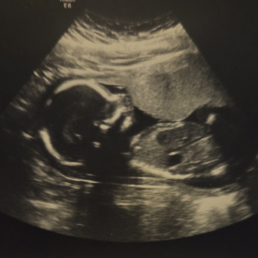 Photo shared by Danielle for their Babylist baby registry.