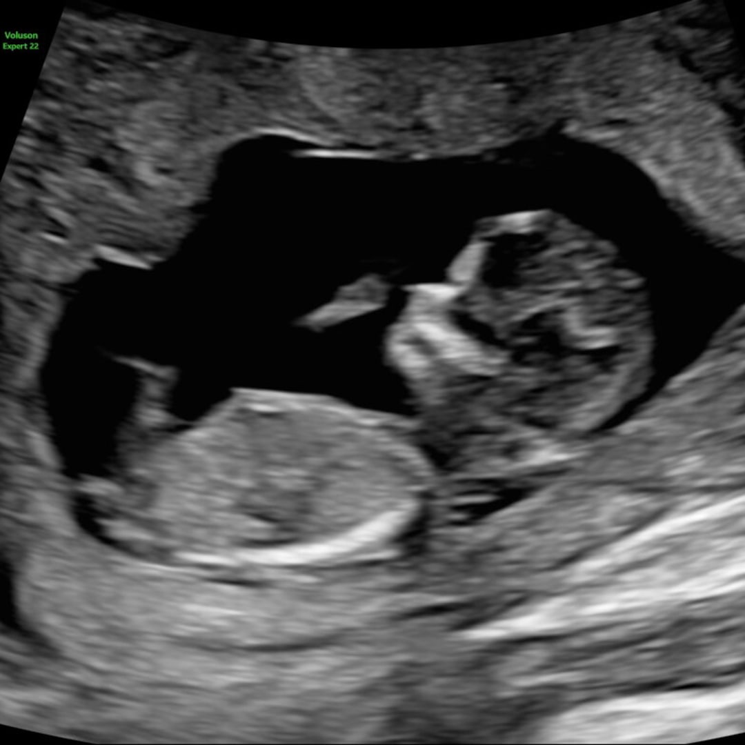 Photo shared by Fatou for their Babylist baby registry.