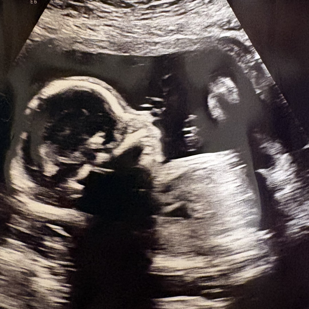 Photo shared by Erica for their Babylist baby registry.