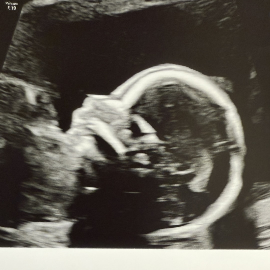 Photo shared by Hadlee for their Babylist baby registry.