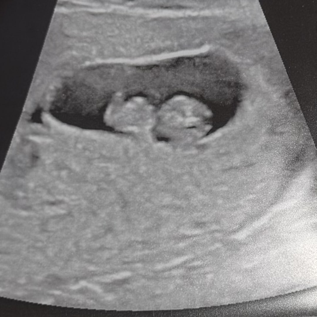 Photo shared by Jamesisha for their Babylist baby registry.